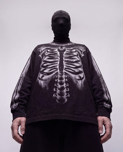 X-ray